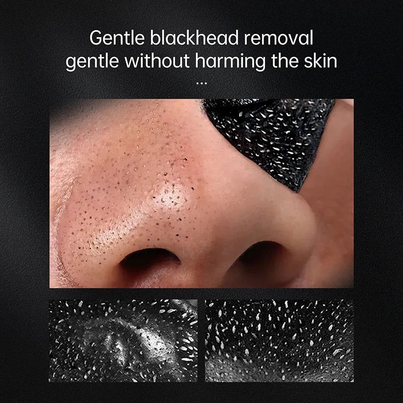 Blackhead Remover Black Dots Facial Masks NoseBamboo Charcoal Point Pimple Anti Acne Spot Face Skin Care Beauty Health